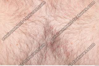 photo texture of hairy skin 0004